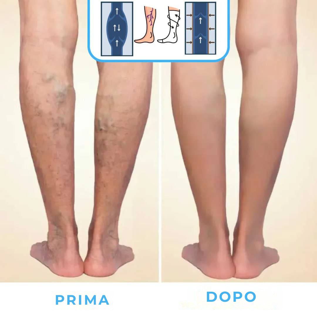 FlowSocks™ - Calze di sostegno